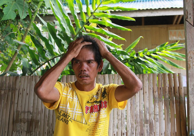 Orlando "Kaido" Engo narrates his ordeal during an interview at Malita Tagakaulo Mission, Barangay Demoloc, Malita, Davao Occidental on March 11, 2016. The 52-year old farmer was accused of masterminding a robbery and was subjected to torture by Army Cpl. Sandy Batolbatol and members of the Special CAFGU Armed Auxiliary (SCAA) under the 72nd Infantry Battalion. The military is currently conducting an investigation after seeing a video posted on Facebook. The chair of the Commission on Human Rights has also ordered an investigation. MindaNews photo by TOTO LOZANO 